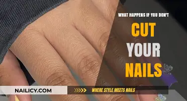 Uncut Nails: A Health Risk and a Haven for Germs