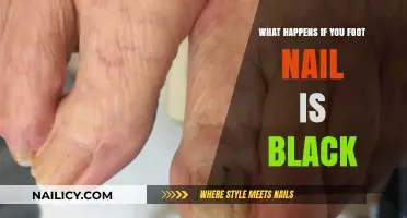 Black Toenail Causes, Symptoms, and Treatment Options Explained