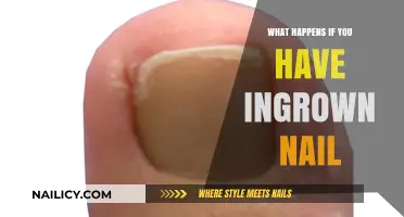 Ingrown Nail Pain: Causes, Symptoms, and Effective Treatment Options