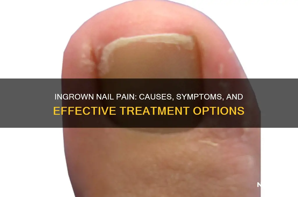 what happens if you have ingrown nail