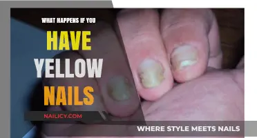 Yellow Nails: Causes, Concerns, and Effective Treatment Options Explained