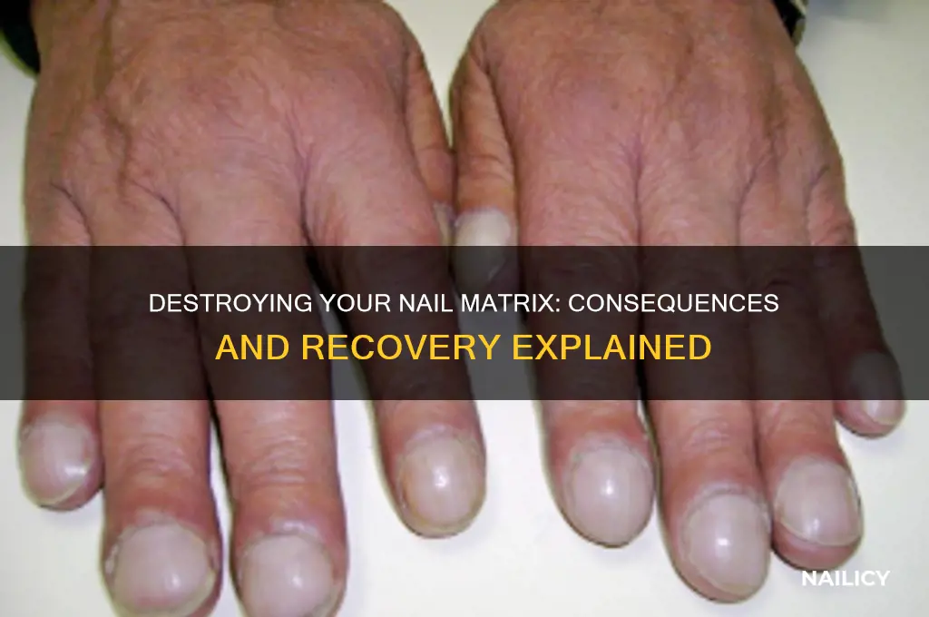 what happens if you kill your nail matrix