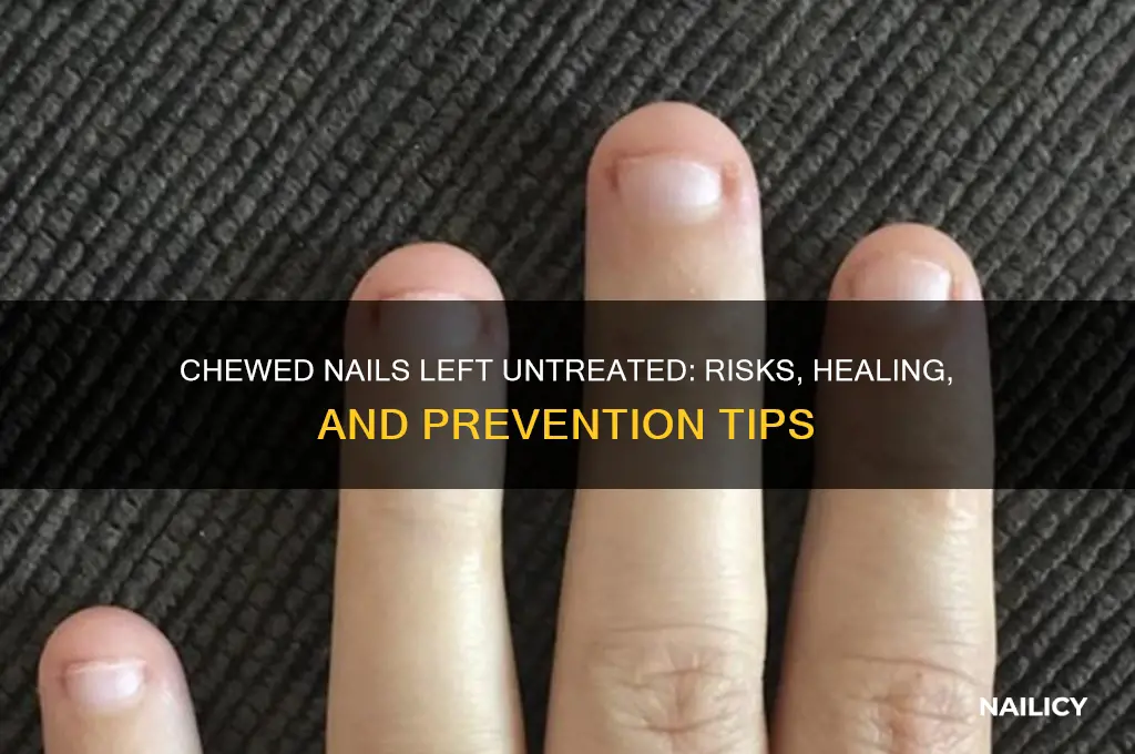 what happens if you leave a chewed nail