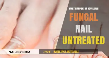 Untreated Fungal Nail Infections: Risks, Complications, and Long-Term Consequences