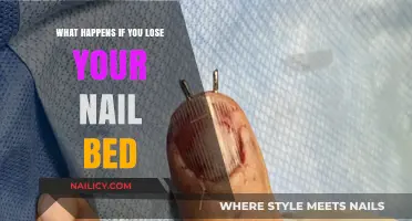 Nail Bed Loss: Causes, Consequences, and Recovery Explained