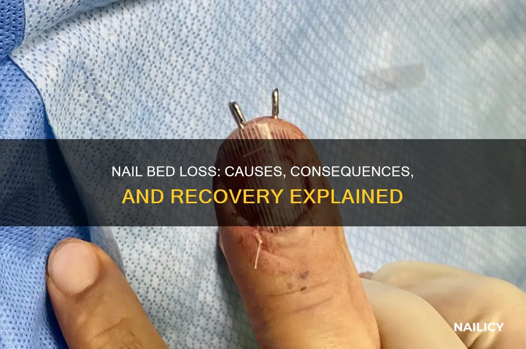 what happens if you lose your nail bed