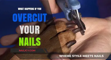 Overcutting Nails: Risks, Consequences, and How to Avoid Damage