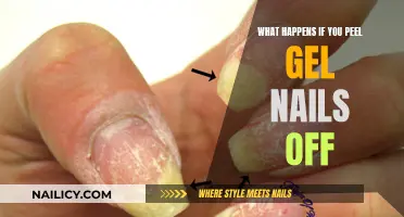 Peeling Gel Nails: Damaging Effects and Risks Explained