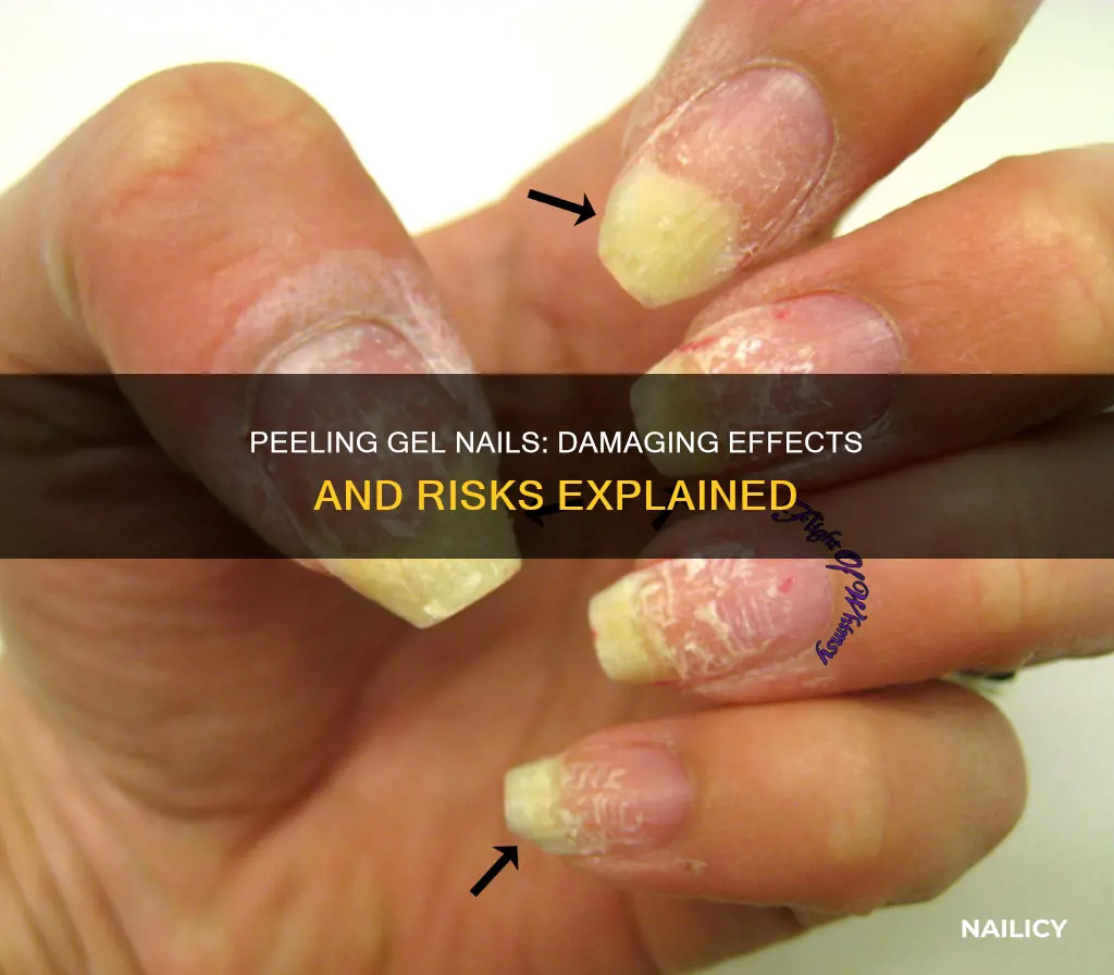 what happens if you peel gel nails off
