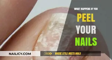 Peeling Your Nails: Risks, Consequences, and How to Prevent Damage
