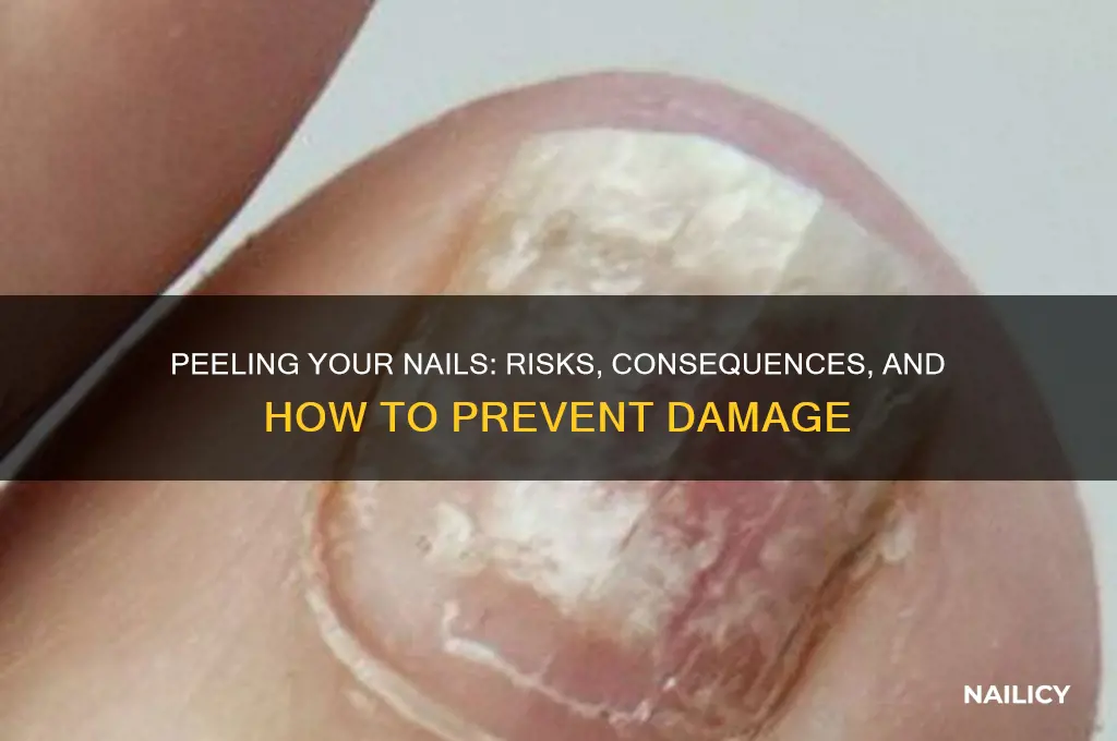 what happens if you peel your nails