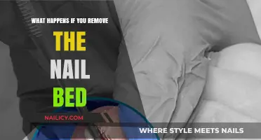 The Devastating Effects of Losing Your Nail Bed