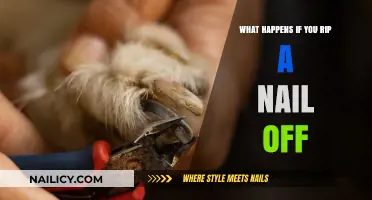 Ripping a Nail Off: Pain, Healing, and What to Expect