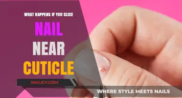 Slicing Nails Near Cuticles: Risks, Pain, and Proper Care Tips