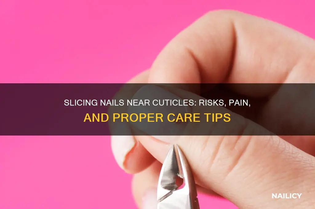 what happens if you slice nail near cuticle