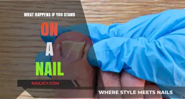 Standing on a Nail: Risks, Reactions, and Necessary First Aid Steps