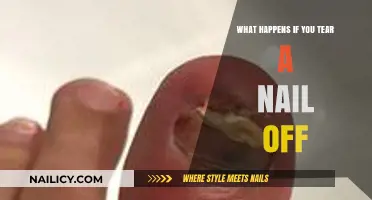 Torn Nail Trauma: What Happens When You Rip a Nail Off?