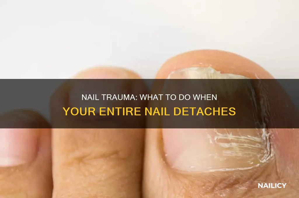 what happens if your entire nail comes off