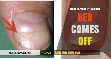 Nail Bed Detachment: Causes, Symptoms, and Treatment Explained