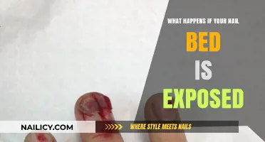 Exposed Nail Bed: Risks, Healing, and Prevention Tips Explained