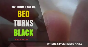Black Nail Bed: Causes, Concerns, and When to Seek Help