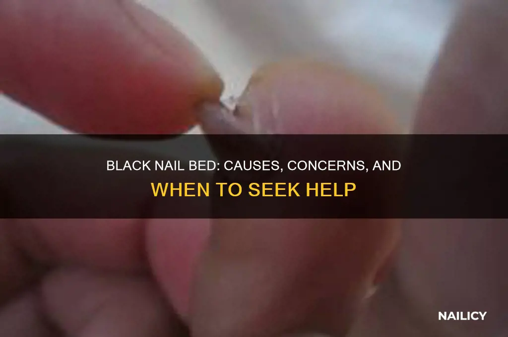 what happens if your nail bed turns black