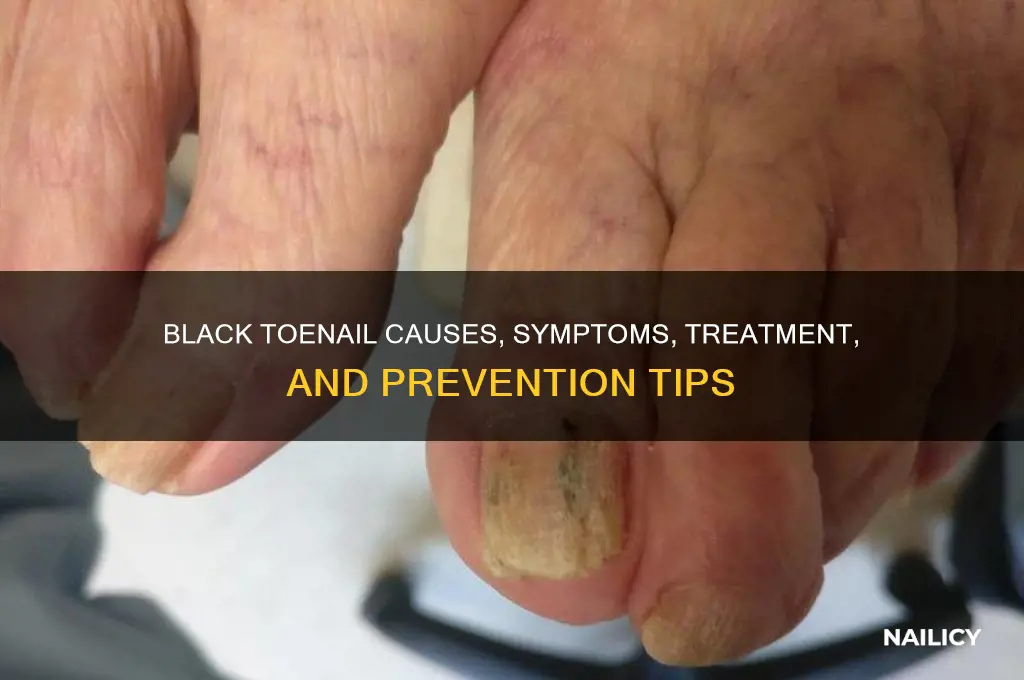 what happens if your nail goes black