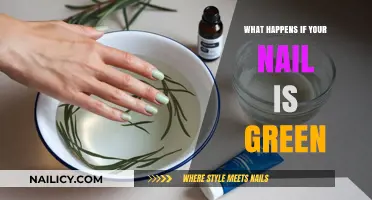 Green Nails: Causes, Concerns, and When to Seek Treatment