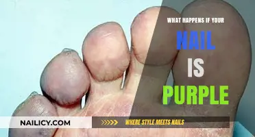 Purple Nail Causes: Understanding Discoloration, Risks, and Treatment Options
