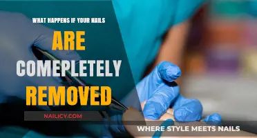 Nail Removal: Exploring the Risks and Recovery