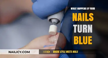 Blue Nails: Causes, Concerns, and When to Seek Medical Help