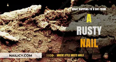 Rusty Nail Cuts: What Are the Risks?