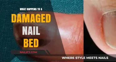 Healing Damaged Nail Beds: Causes, Symptoms, and Recovery Process Explained