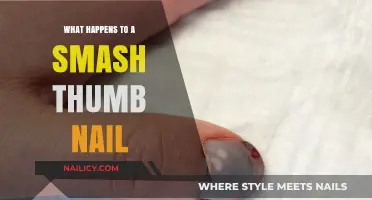 Smash Thumb Nail Injury: Healing Process, Pain Relief, and Recovery Tips