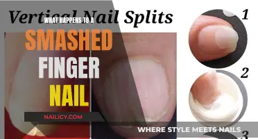 Healing a Broken Nail: From Smashed to Strong Again