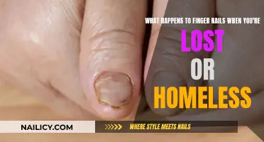 Nails' Tale: When Homelessness Meets Fingernails