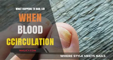 How Poor Blood Circulation Affects Your Nail Health and Lid Appearance