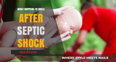 Septic Shock's Impact: Understanding Nail Changes and Recovery Process