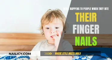 Nail-Biting Habit: Its Impact on Health and Wellbeing