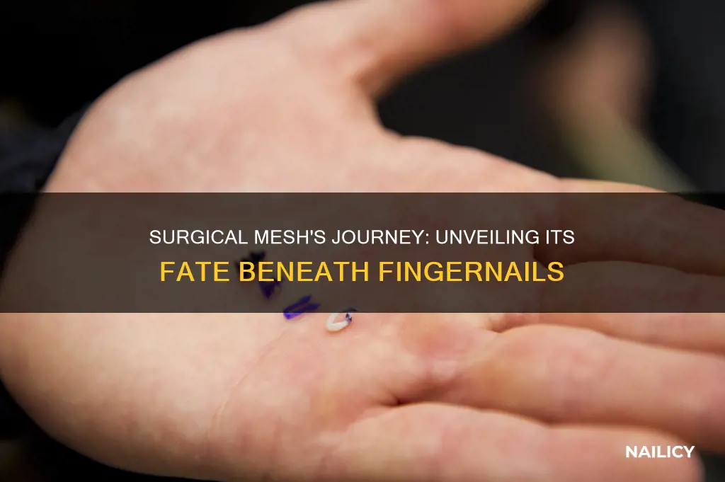 what happens to surgical mesh under a finger nail