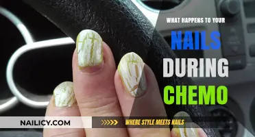 Chemotherapy's Impact: Understanding Nail Changes During Cancer Treatment