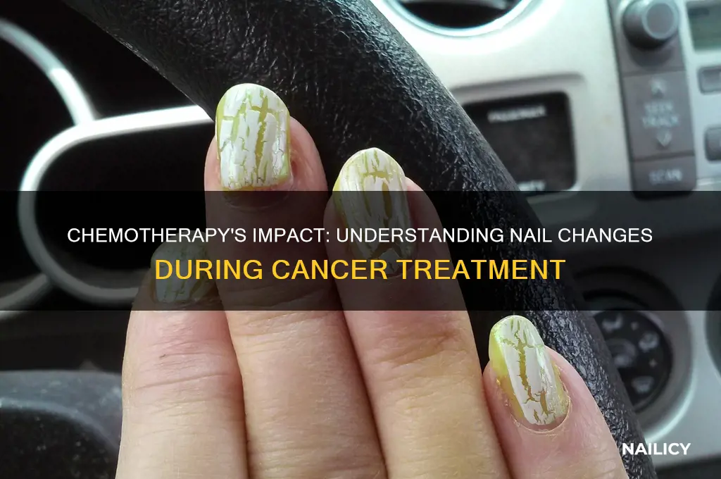 what happens to your nails during chemo