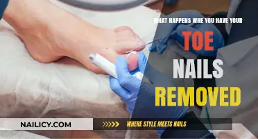 Toe Nail Removal: What to Expect and Why