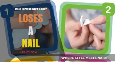 Baby Nail Loss: What to Expect and How to Care