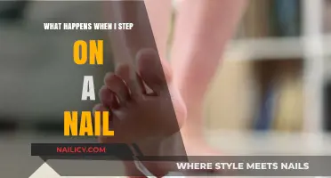 Stepping on a Nail: Risks, Reactions, and Immediate Actions to Take