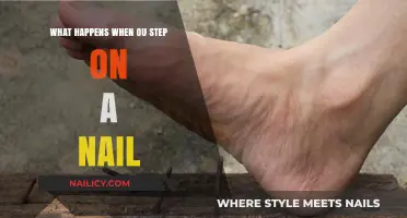 Stepping on a Nail: Risks, Reactions, and Immediate First Aid Steps