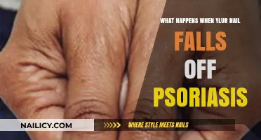 Nail Loss and Psoriasis: Understanding Causes, Care, and Recovery