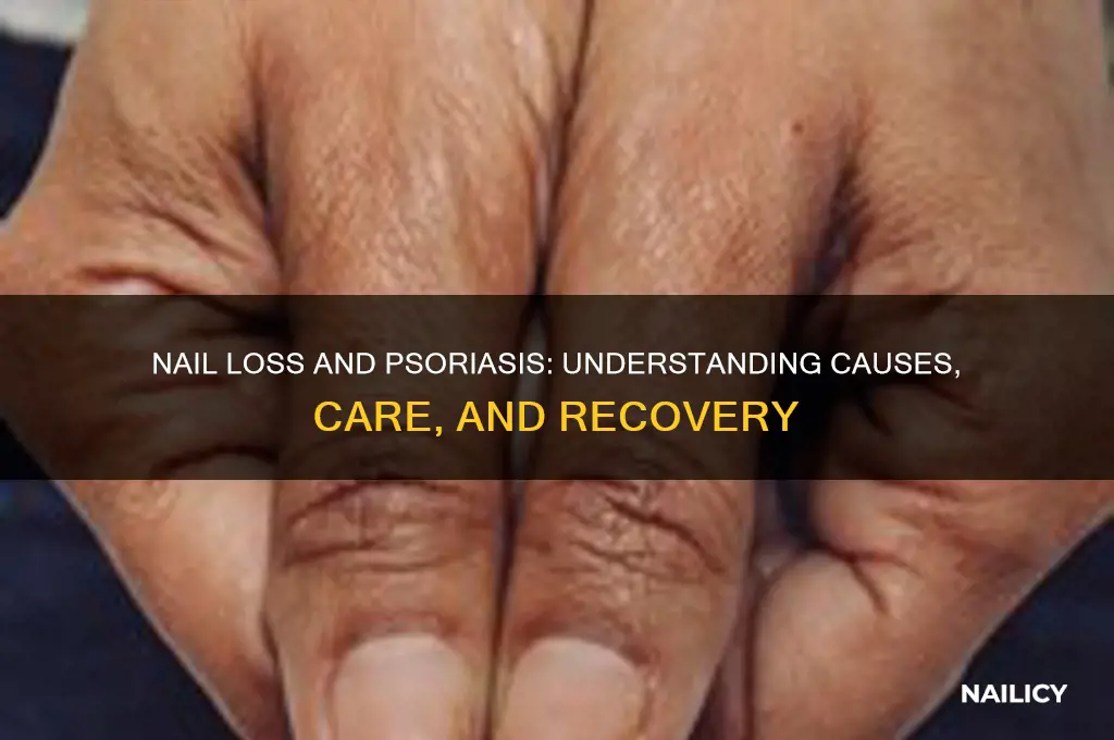 what happens when ylur nail falls off psoriasis