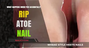 Accidentally Ripped a Toenail? Here’s What to Expect and How to Heal