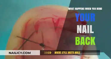 Bending Nails Back: Pain, Risks, and Recovery Explained